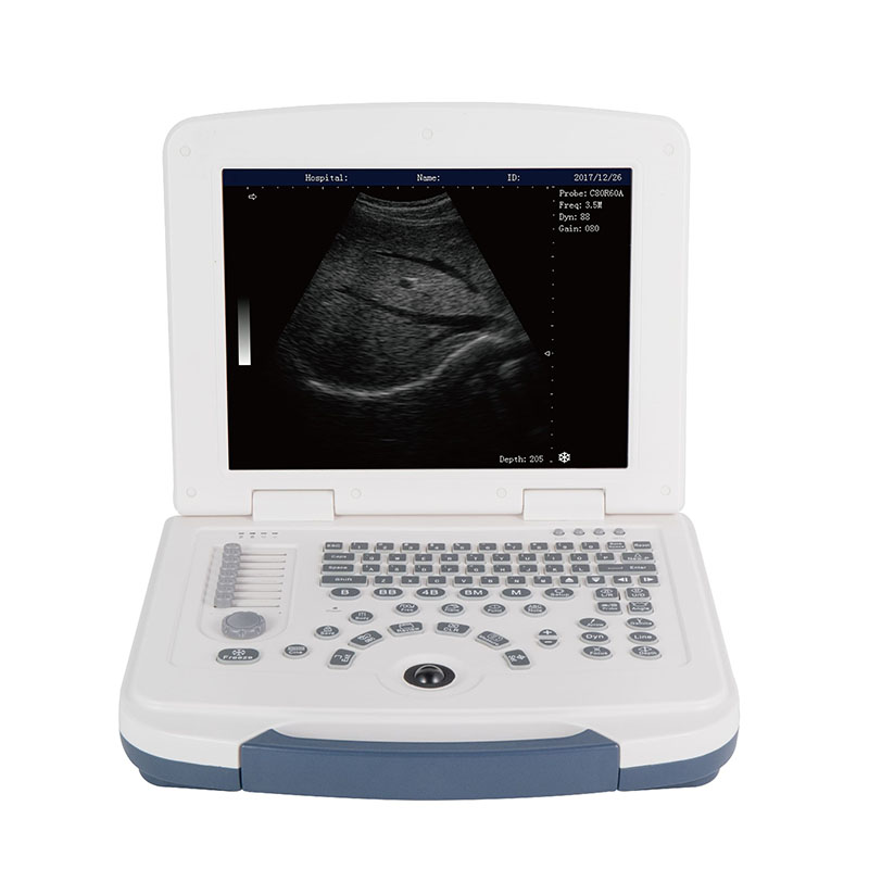 Portable Black and White Ultrasound Machine