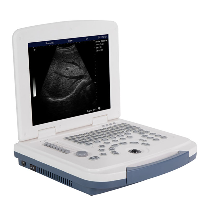 Portable Black and White Ultrasound Machine