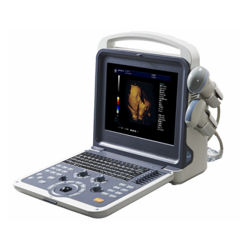 Portable type Color doppler