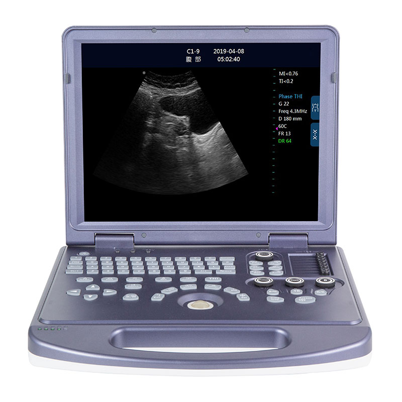 Portable Black and White Ultrasound Machine