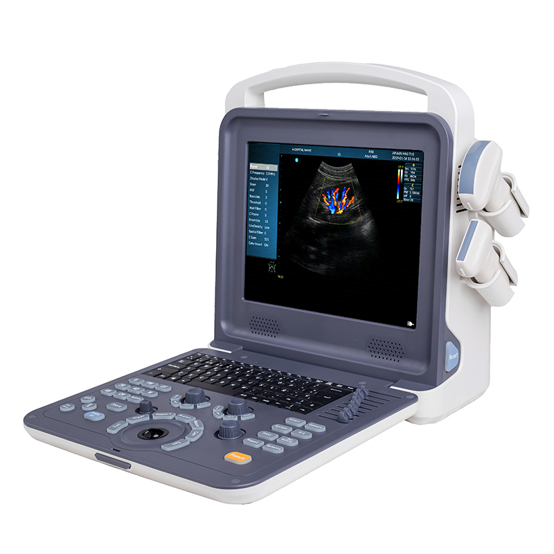 Portable type Color doppler