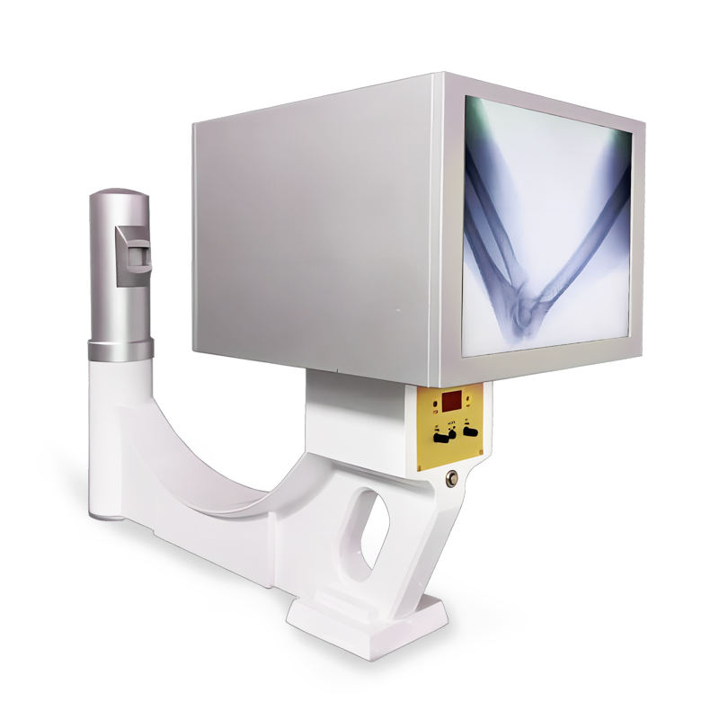 Smart Portable X-ray Machine